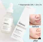 The Ordinary Niacinamide 10% + Zinc 1% Face serum